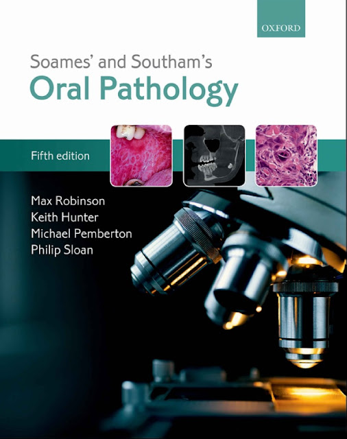 Soames’ and Southam’s Oral Pathology