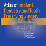 Atlas of Implant Dentistry and Tooth-Preserving Surgery