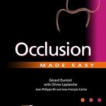 Occlusion-Made-Easy