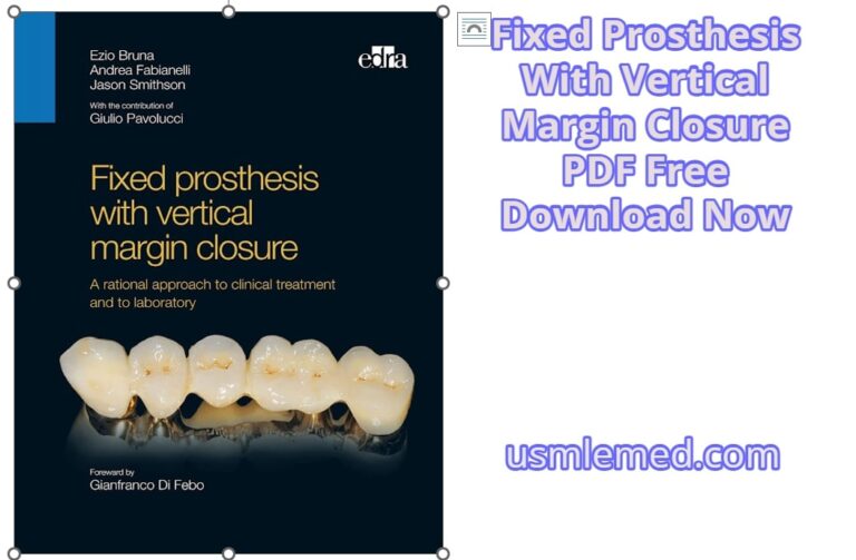 Fixed Prosthesis With Vertical Margin Closure PDF Free Download (Google Drive)