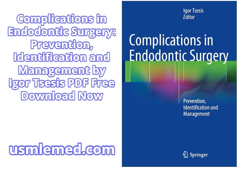 Complications in Endodontic Surgery Prevention, Identification and Management by Igor Tsesis PDF Free Download (Direct Link)