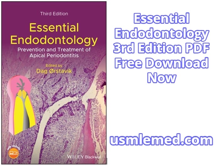 Essential Endodontology 3rd Edition PDF Free Download