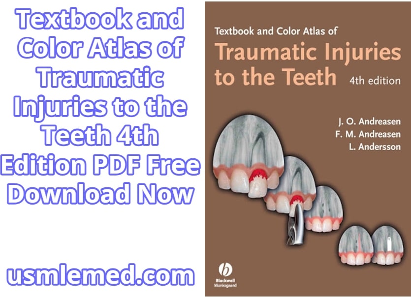 Textbook and Color Atlas of Traumatic Injuries to the Teeth 4th Edition PDF Free Download (Direct Link)