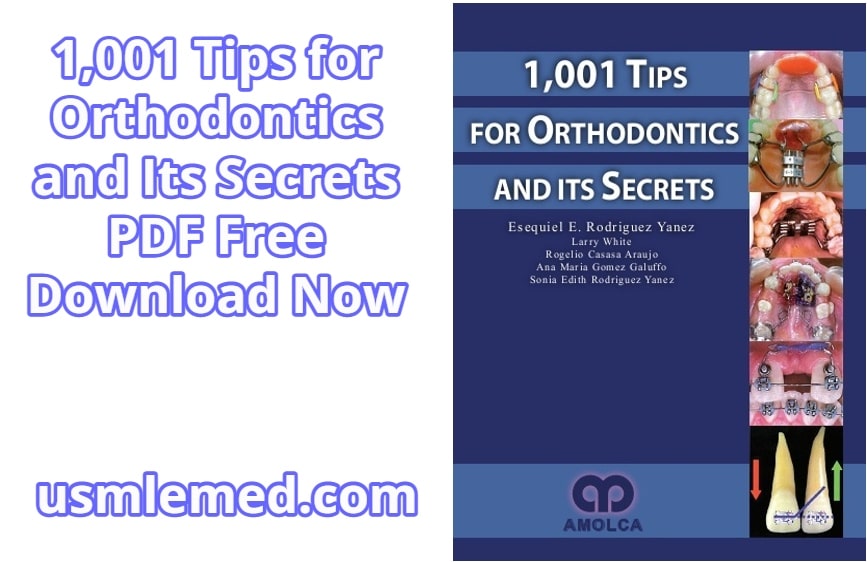 1,001 Tips for Orthodontics and Its Secrets PDF Free Download (Direct Link)