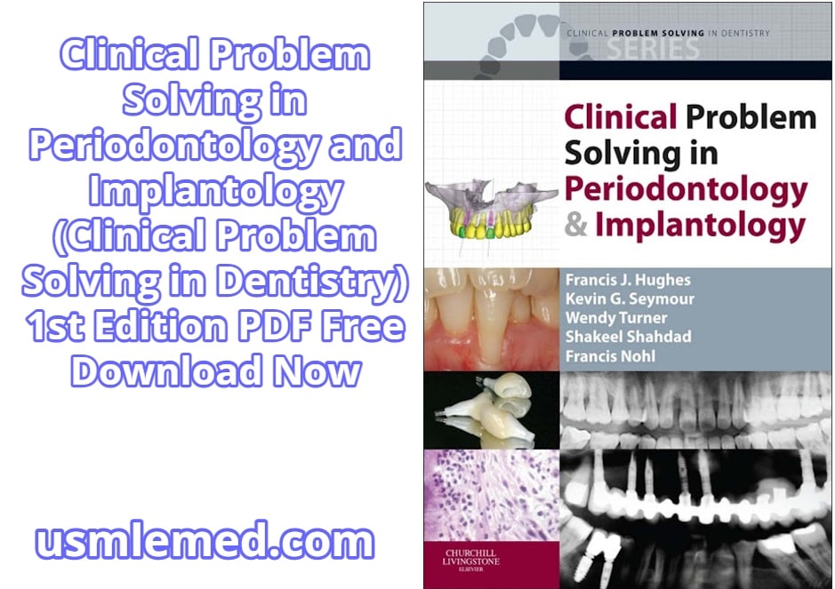 Clinical Problem Solving in Periodontology and Implantology (Clinical Problem Solving in Dentistry) 1st Edition PDF Free Download (Direct Link)