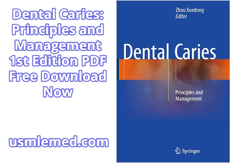 Dental Caries Principles and Management 1st Edition PDF Free Download (Direct Link)
