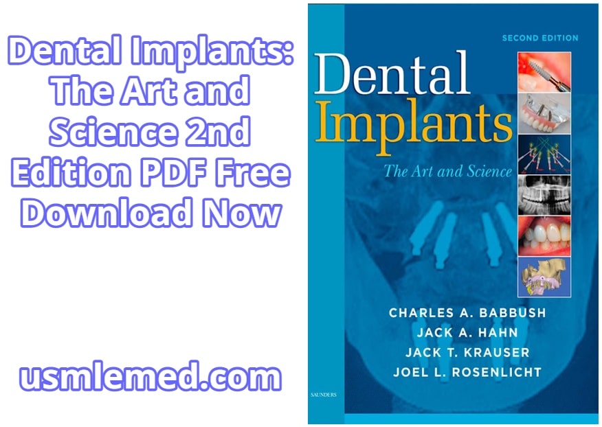 Dental Implants The Art and Science 2nd Edition PDF Free Download (Direct Link)