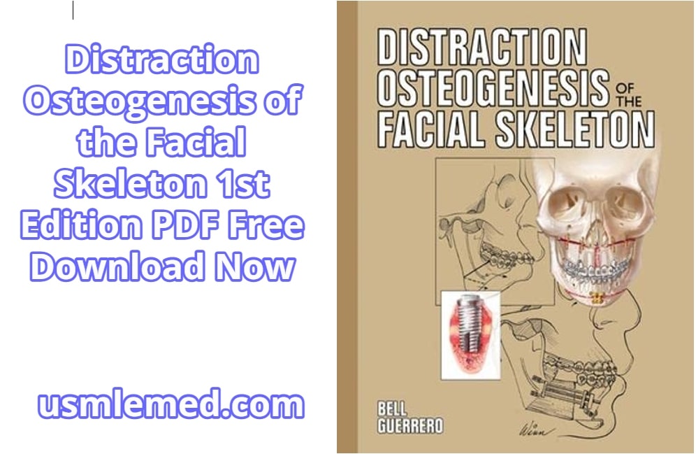 Distraction Osteogenesis of the Facial Skeleton 1st Edition PDF Free Download (Direct Link)