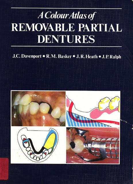 A color atlas of removable partial dentures PDF Free Download (Direct Link)