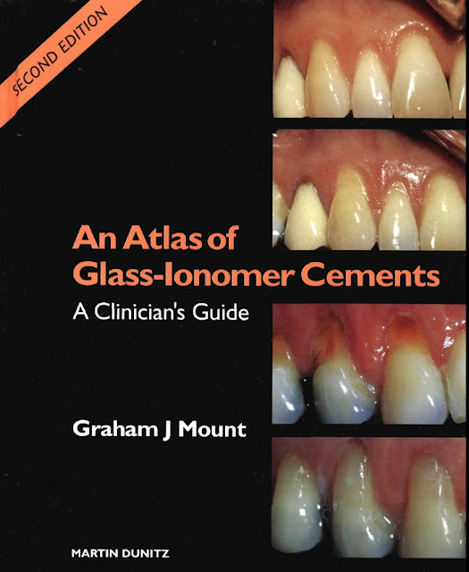 An Atlas of Glass-Ionomer Cements A Clinician’s Guide 2nd Edition PDF Free Download (Direct Link)