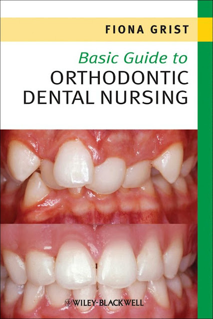 Basic Guide to Orthodontic Dental Nursing (Basic Guide Dentistry Series) 2nd Edition PDF Free Download (Direct Link)