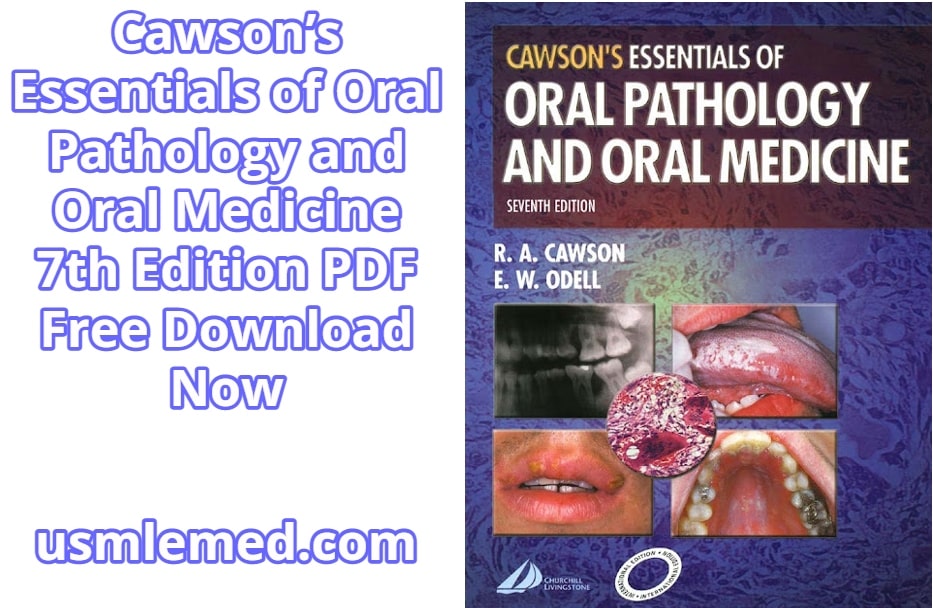 Cawson’s Essentials of Oral Pathology and Oral Medicine 7th Edition PDF Free Download (Direct Link)