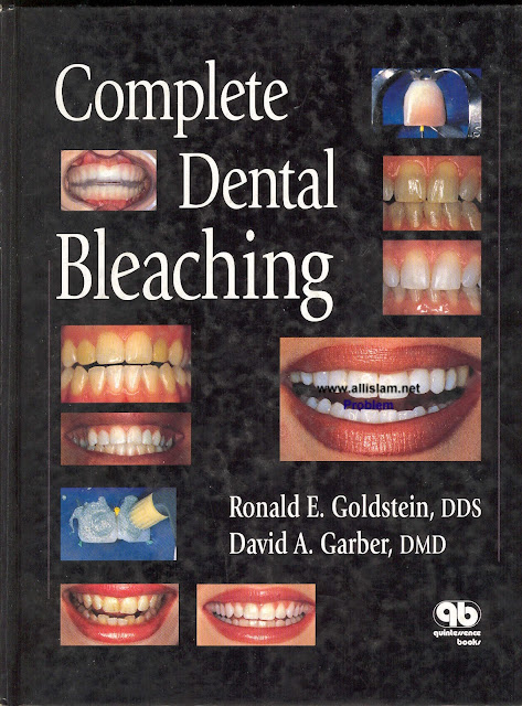 Complete Dental Bleaching 1st Edition PDF Free Download (Direct Link)