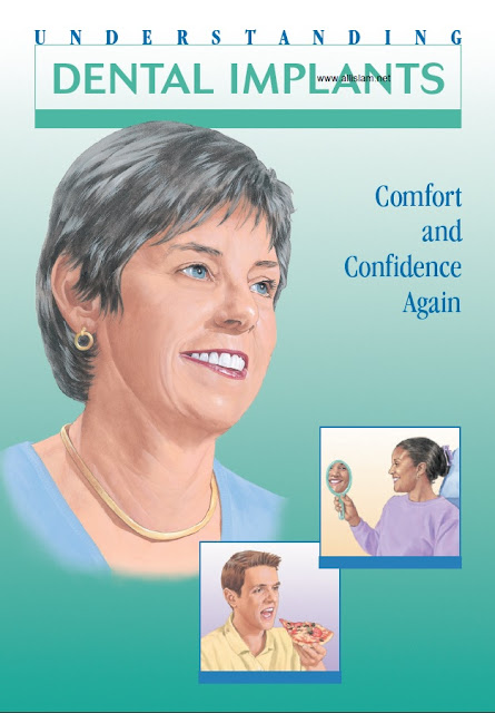 Dental Implants Comfort and Confidence Again PDF Free Download (Direct Link)