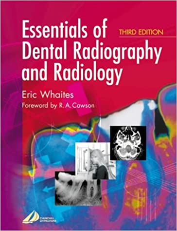 Essentials of Dental Radiography and Radiology 3rd Edition PDF Free Download (Direct Link)