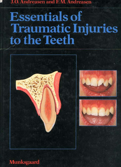 Essentials of Traumatic Injuries to the Teeth A Step-by-Step Treatment Guide 2nd Edition PDF Free Download (Direct Link)