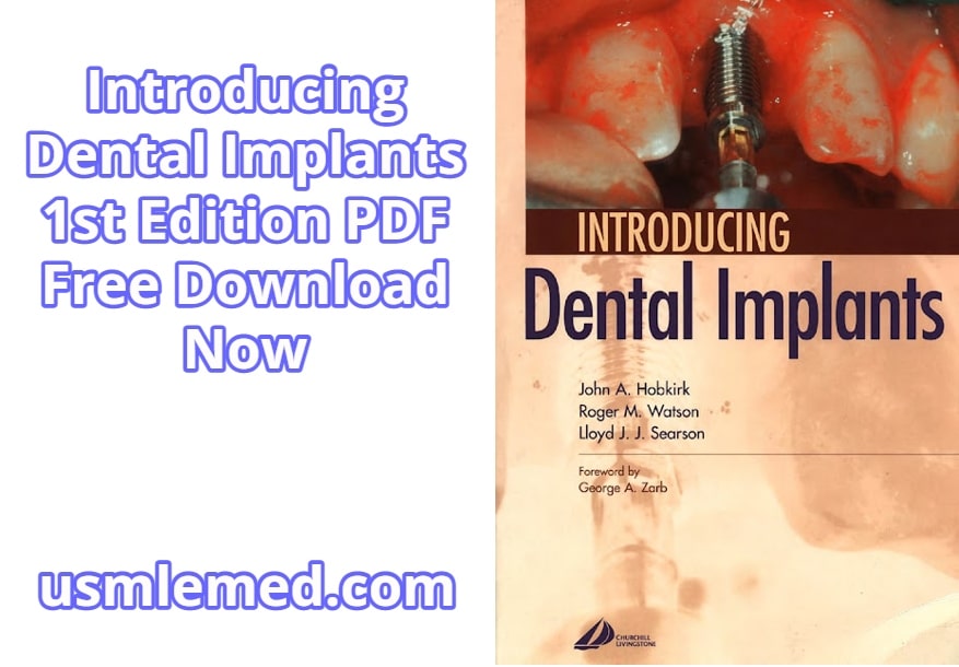 Introducing Dental Implants 1st Edition PDF Free Download (Direct Link)