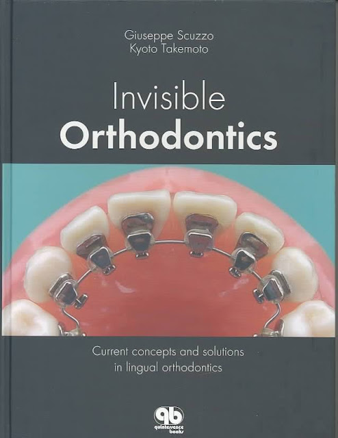 Invisible Orthodontics Current Concepts and Solutions in Lingual Orthodontics PDF Free Download (Direct Link)