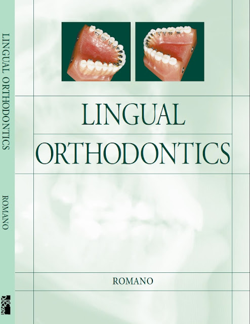 Lingual Orthodontics PDF Free Download (Direct Link)