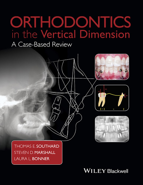 Orthodontics in the Vertical Dimension A Case Based Review PDF Free Download (Direct Link)