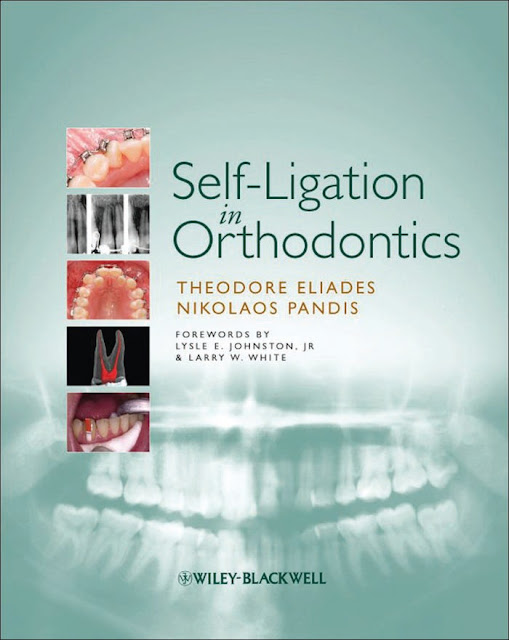 Self-Ligation in Orthodontics 1st Edition PDF Free Download (Direct Link)