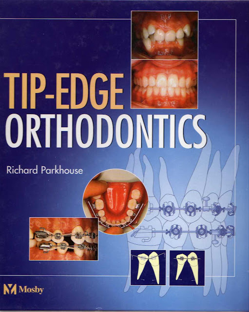 Tip Edge Orthodontics PDF Free Download (Direct Link)