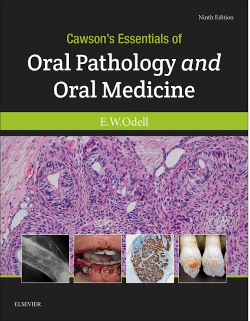 Cawson’s Essentials of Oral Pathology and Oral Medicine 9th Edition PDF Free Download (Direct Link)