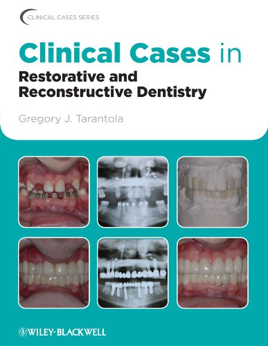 Clinical Cases in Restorative and Reconstructive Dentistry PDF Free Download (Direct Link)