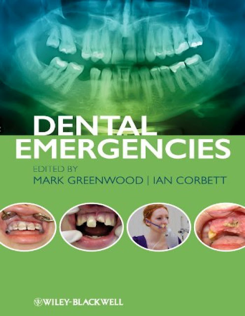 Dental Emergencies 1st Edition PDF Free Download (Direct Link)