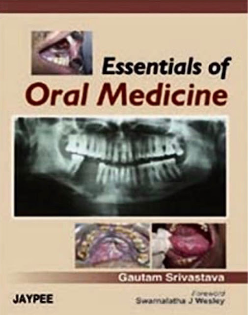 Essentials of Oral Medicine PDF Free Download (Direct Link)