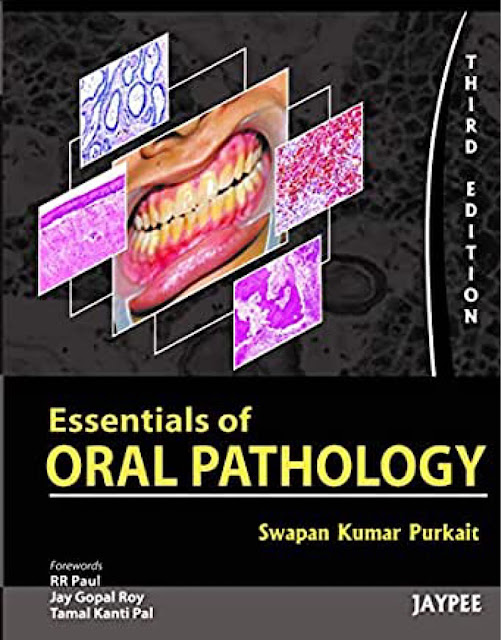 Essentials of Oral Pathology PDF Free Download (Direct Link)