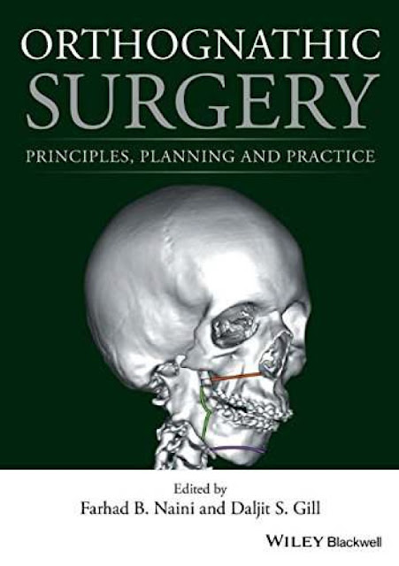Orthognathic Surgery Principles Planning and Practice PDF Free Download (Direct Link)