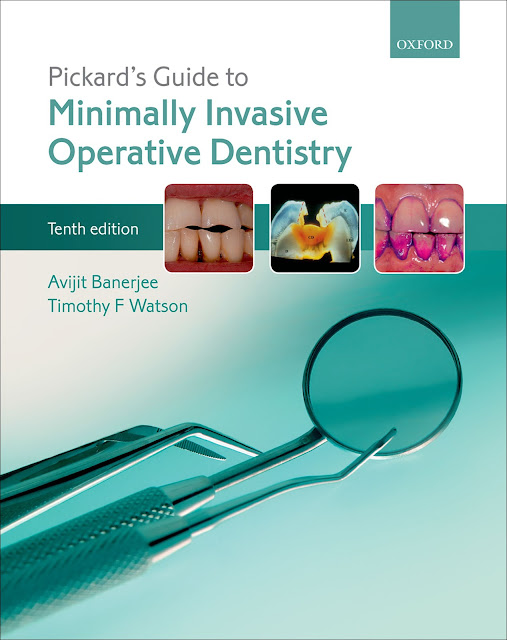 Pickard’s Guide to Minimally Invasive Operative Dentistry PDF Free Download (Direct Link)