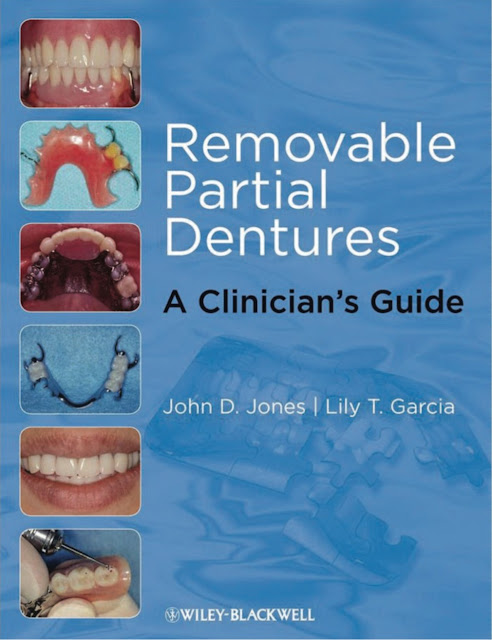 Removable Partial Dentures A Clinican Guide PDF Free Download (Direct Link)