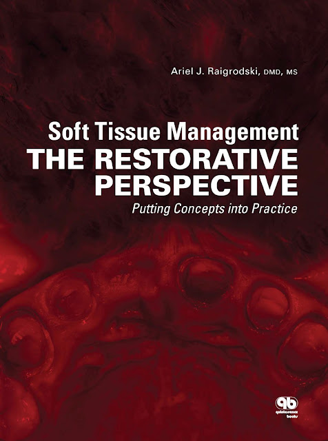 Soft Tissue Management the Restorative Perspective Putting Concepts into Practices PDF Free Download (Direct Link)