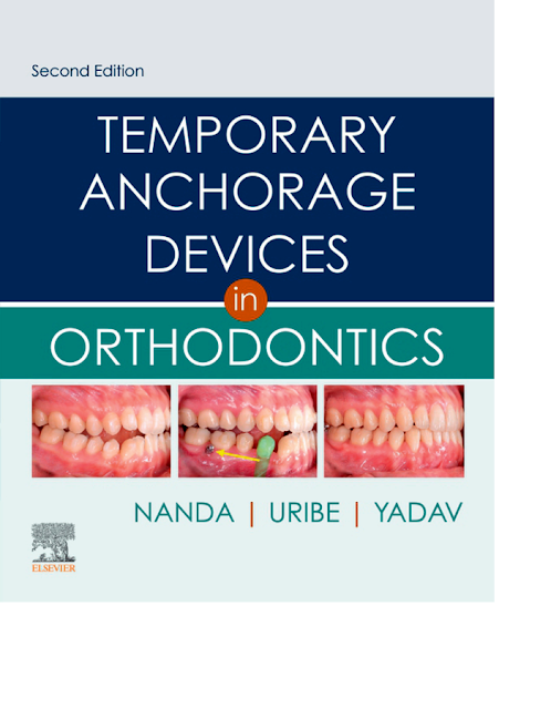Temporary Anchorage Devices in Orthodontics PDF Free Download (Direct Link)