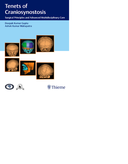 Tenets of Craniosynostosis Surgerical Prinicpal and Advanced Multidisciplinary Care PDF Free Download (Direct Link)