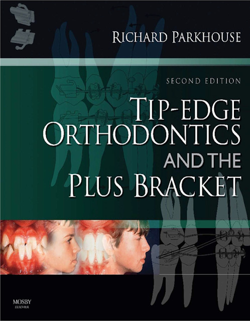 Tip Edge Orthodontics and The Plus Bracket PDF Free Download (Direct Link)