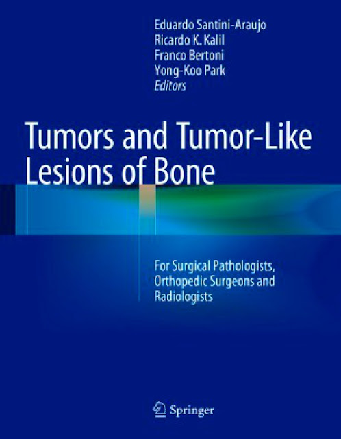 Tumors and Tumor Like lessions of Bone 2nd Edition PDF Free Download (Direct Link)