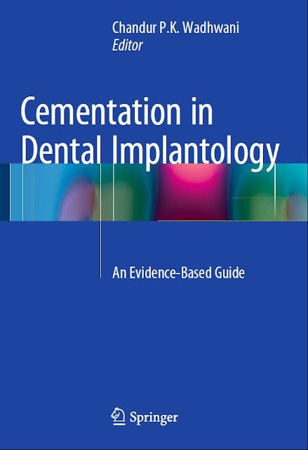 Cementation in Dental Implantology An Evidence Based Guide PDF Free Download (Direct Link)
