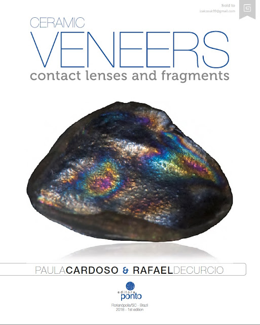 Ceramic Veneers Contact Lenses and Fragments PDF Free Download (Direct Link)