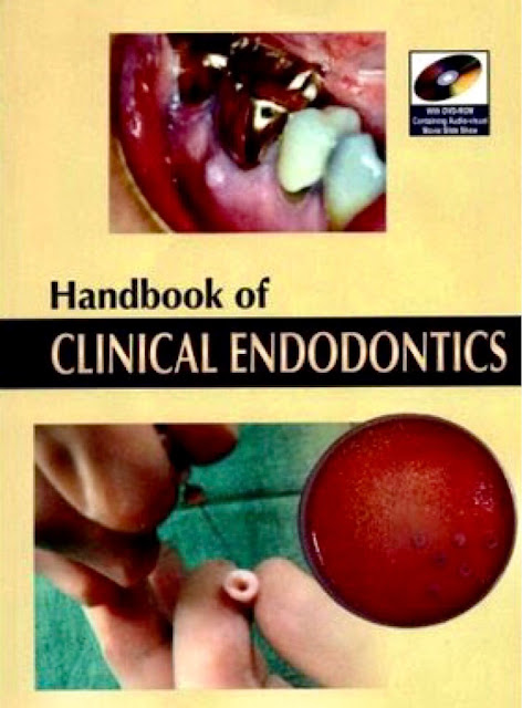 Handbook of Clinical Endodontics 3rd Edition PDF Free Download (Direct Link)