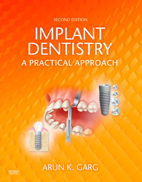 Implant Dentistry A Practical Approach 2nd Edition PDF Free Download (Direct Link)