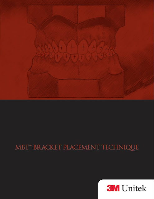 MBT Brackets Placements Technique PDF Free Download (Direct Link)