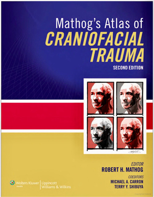Mathog’s Atlas of Craniofacial Trauma 2nd Edition PDF Free Download (Direct Link)