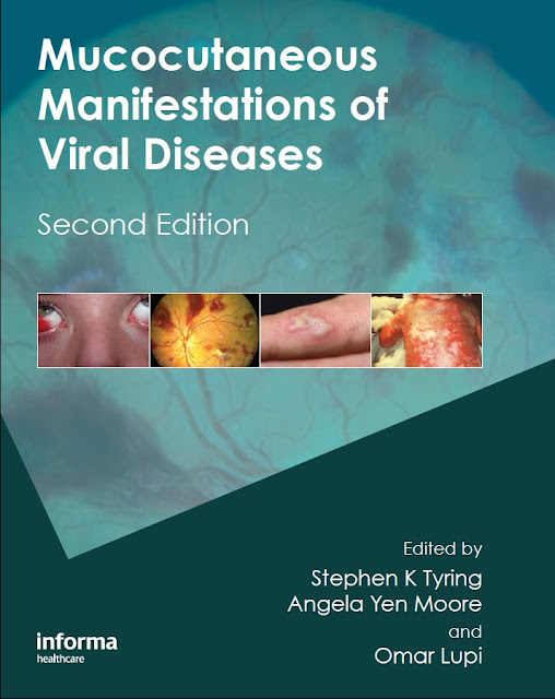 Mucocutaneous Manifestations of Viral Diseases 2nd Edition PDF Free Download (Direct Link)