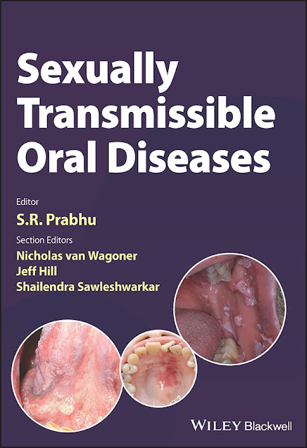 Sexually Transmissible Oral Diseases PDF Free Download (Direct Link)