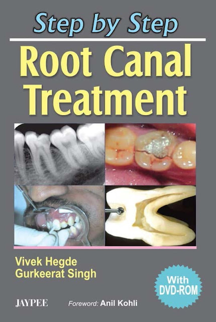 Step by Step Root Canal Treatment PDF Free Download (Direct Link)